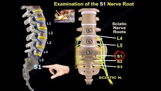 Examination Of S1 Nerve Root  Everything You Need To Know  Dr Nabil Ebraheim [upl. by Conney158]