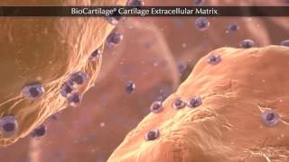 BioCartilage® Cartilage Extracellular Matrix [upl. by Imelda]