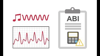 Performing a manual anklebrachial index ABI [upl. by Corrianne507]