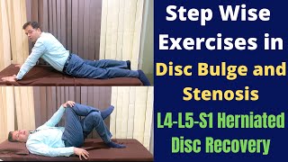 Exercises For Herniated Disc Disc Bulge L4L5S1 Step Wise Treatment for Slipped Disc Recovery [upl. by Dyanne628]