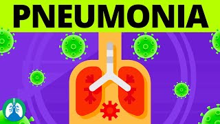 Pneumonia Overview  Causes Symptoms Diagnosis and Treatment [upl. by Ahsiuqel691]