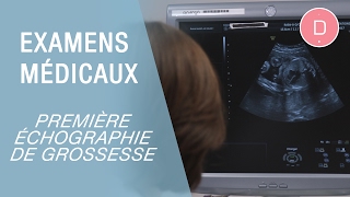 La première échographie de grossesse  Examens grossesse [upl. by Delora]