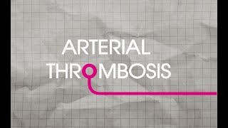 Arterial Thrombosis Explained [upl. by Giltzow]