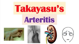 Takayasu’s Arteritis Pulseless Disease  Large Vessel Vasculitis Symptoms Diagnosis Treatment [upl. by Thynne]