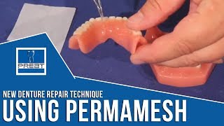 New Denture Repair Technique Using Perma Mesh By PREAT Corporation [upl. by Ielhsa194]