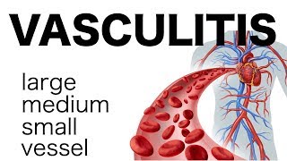 Vasculitis [upl. by Eniledam]