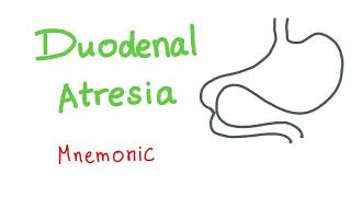 Duodenal Atresia Mnemonic [upl. by Ceciley]