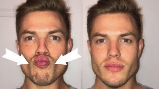 3 Exercises To Lose CHUBBY Cheeks Get a Defined Face [upl. by Hairu592]