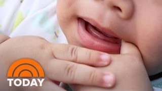 How To Deal With Teething New Baby Basics  TODAY [upl. by Marjorie]