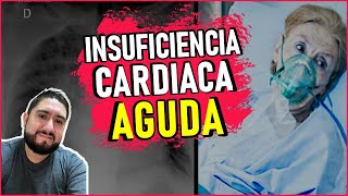 INSUFICIENCIA CARDIACA AGUDAABORDAJE EMERGENTE BY DR ZAMARRÓN [upl. by Inaluahek]