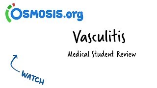 Vasculitis  Clinical Presentation [upl. by Sarkaria497]