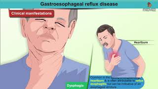 Gastroesophageal Reflux Disease GERD Treatment amp Prevention  Dr Anupam Mahapatra [upl. by Rabjohn]