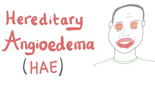 Hereditary Angioedema HAE [upl. by Havot986]