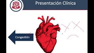 Insuficiencia Cardiaca  Fisiopatología Clínica y Diagnostico [upl. by Calla]