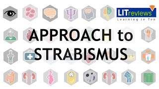 Approach to Strabismus [upl. by Herb622]