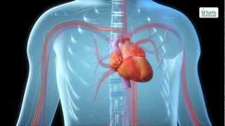 Angioplasty amp Stenting  Medical Animation [upl. by Renard272]