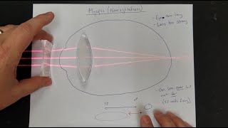 Vision Correction Normal Eyes Myopia Hyperopia Near amp Far Point Lens Power [upl. by Todd]