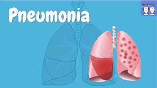 Pneumonia by B Fissel P Stoeck  OPENPediatrics [upl. by Eirb]