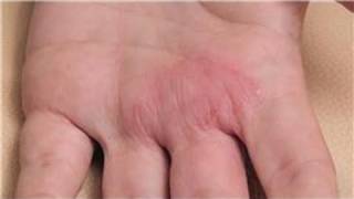 Dermatology Treatments  How to Diagnose Skin Rashes [upl. by Alegnave342]