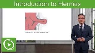 Hiatal Hernia  All 4 Types Explained [upl. by Cunningham631]