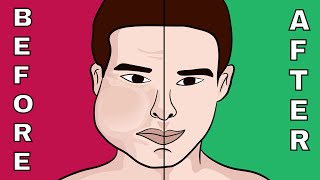 The 7 Fastest Techniques to Burn Face Fat Naturally [upl. by Esilahs]