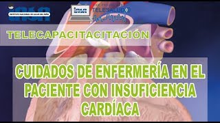 Enfermería en el Paciente con Insuficiencia Cardíaca  Telecapacitación INSN [upl. by Fran431]