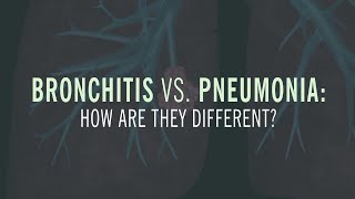 Pneumonia – A Serious Condition to be Taken Seriously [upl. by Ella640]