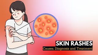 Skin Rash Causes Signs and Symptoms Diagnosis and Treatment [upl. by Amorette364]