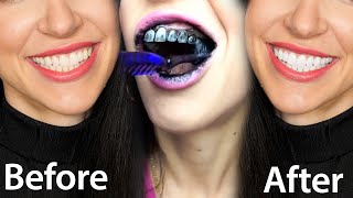 Fastest Way To Whiten Teeth At Home What REALLY Works [upl. by Plato]